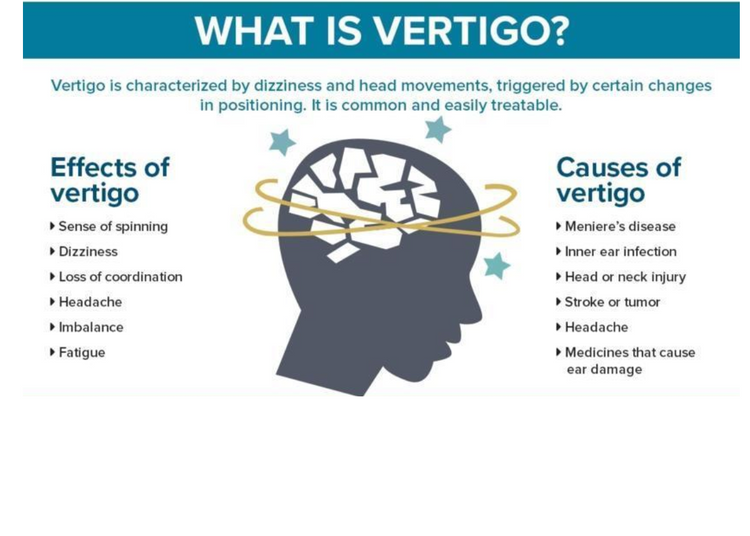VertiSensations - Vertigo